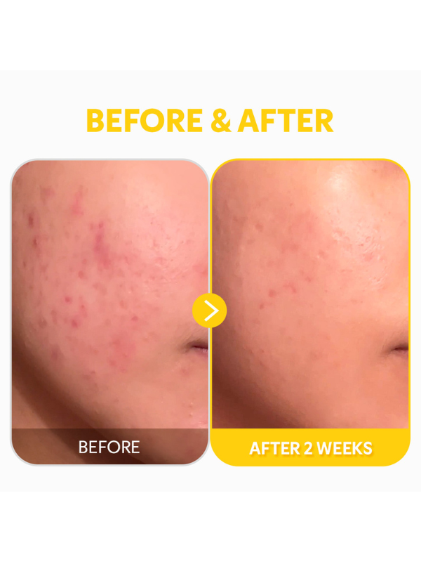 TIRTIR Pure Vitamin C24 Serum bottle surrounded by citrus fruit slices representing vitamin C rich ingredients